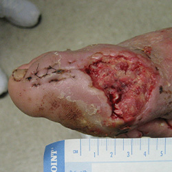 RPI_Before-After_250x250-10a RPI_Before-After_250x250-10a