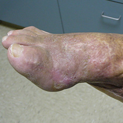 RPI_Before-After_250x250-10b