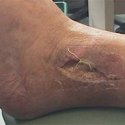 RPI_Before-After_250x250-11a RPI_Before-After_250x250-11a