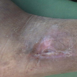 RPI_Before-After_250x250-11b