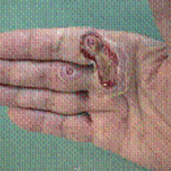 RPI_Before-After_250x250-12a RPI_Before-After_250x250-12a