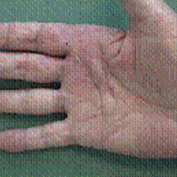 RPI_Before-After_250x250-12b