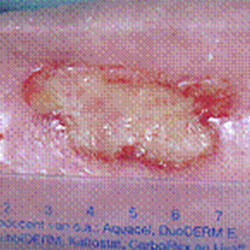 RPI_Before-After_250x250-14a RPI_Before-After_250x250-14a