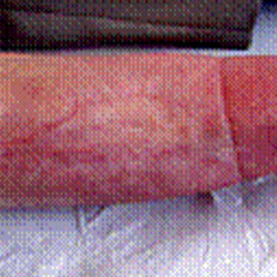 RPI_Before-After_250x250-14b