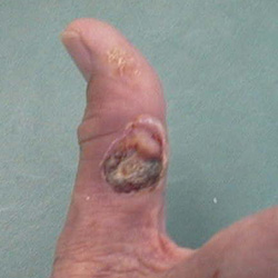 RPI_Before-After_250x250-15a RPI_Before-After_250x250-15a