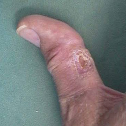 RPI_Before-After_250x250-15b