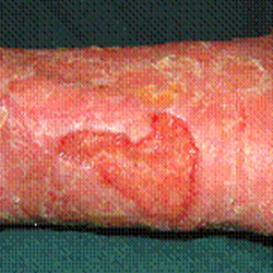 RPI_Before-After_250x250-16a RPI_Before-After_250x250-16a