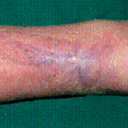 RPI_Before-After_250x250-16b