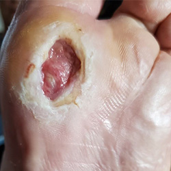 RPI_Before-After_250x250-1a RPI_Before-After_250x250-1a