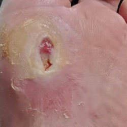 RPI_Before-After_250x250-1b