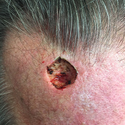 RPI_Before-After_250x250-2a RPI_Before-After_250x250-2a