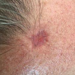 RPI_Before-After_250x250-2b