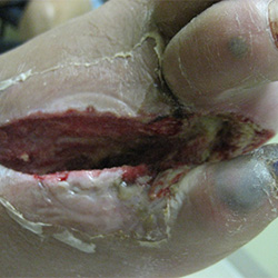 RPI_Before-After_250x250-3a RPI_Before-After_250x250-3a