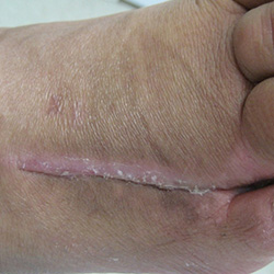 RPI_Before-After_250x250-3b