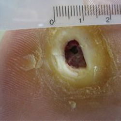 RPI_Before-After_250x250-4a RPI_Before-After_250x250-4a