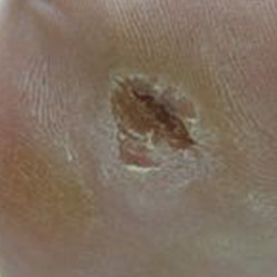 RPI_Before-After_250x250-4b