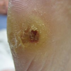 RPI_Before-After_250x250-5a RPI_Before-After_250x250-5a