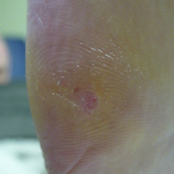 RPI_Before-After_250x250-5b