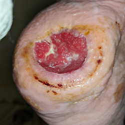 RPI_Before-After_250x250-6a RPI_Before-After_250x250-6a