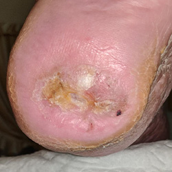 RPI_Before-After_250x250-6b