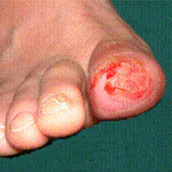 RPI_Before-After_250x250-7a RPI_Before-After_250x250-7a