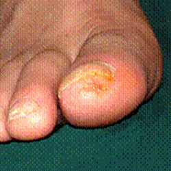 RPI_Before-After_250x250-7b