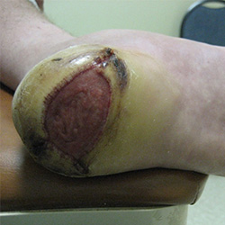 RPI_Before-After_250x250-8a RPI_Before-After_250x250-8a