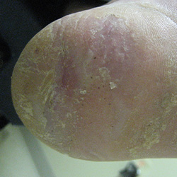 RPI_Before-After_250x250-8b