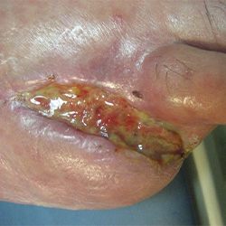 RPI_Before-After_250x250-9a RPI_Before-After_250x250-9a