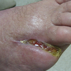 RPI_Before-After_250x250-9b